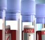 Zika: estudo avalia doença em pacientes com HIV controlado