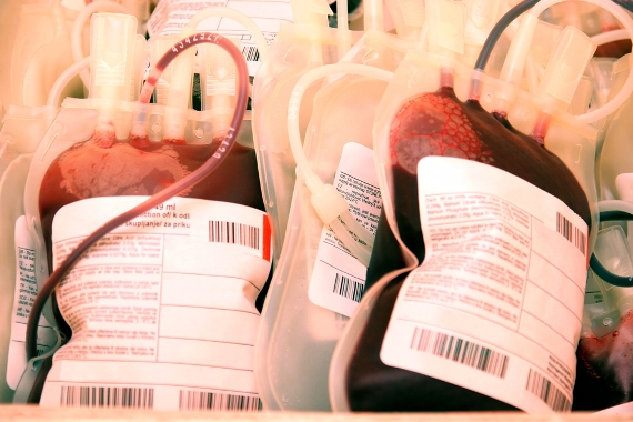 Estoques de sangue do Hemorio estão em nível crítico