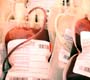 Estoques de sangue do Hemorio estão em nível crítico