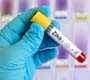 OMS afirma que Brasil tem agido rápido nas investigações do vírus Zika 