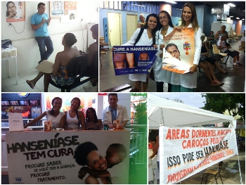 Dia Mundial de Luta Contra a Hanseníase foi marcado com ações de conscientização