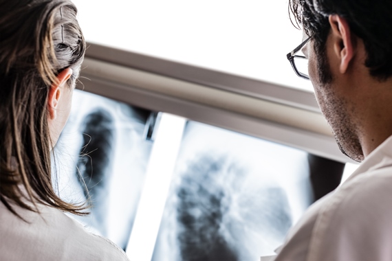 Tuberculose: SES realiza reuniões e ações de capacitação e treinamento 