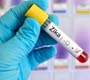 Evento internacional marca um ano da crise de zika no Brasil