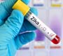 Instituições de 11 países formam consórcio para estudar o vírus Zika