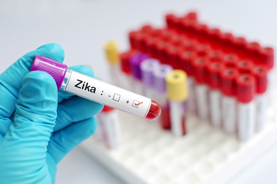 OMS aponta o vírus Zika como causa do aumento dos casos de microcefalia