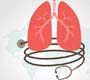 Mais de 70 países prometem tomar medidas urgentes para acabar com tuberculose até 2030