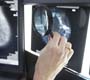 Rio Imagem chega ao Outubro Rosa com anúncio de dois novos mamógrafos