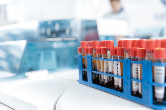 Fiocruz conduzirá estudo inédito sobre prevenção ao HIV