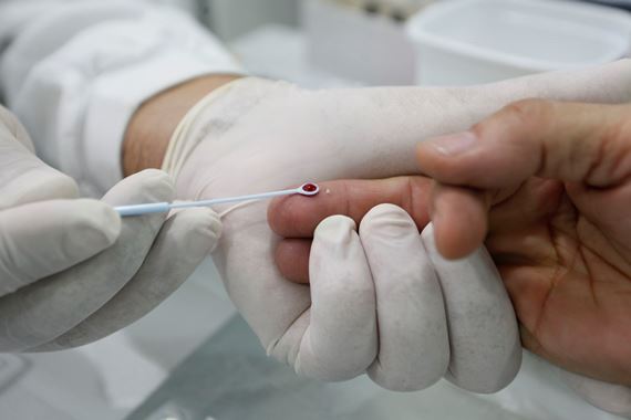 Testes rápidos de hepatite durante o Julho Amarelo