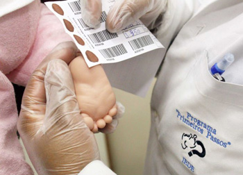 Teste do Pezinho: mais de 71 mil exames realizados nos cinco primeiros meses de 2012 
