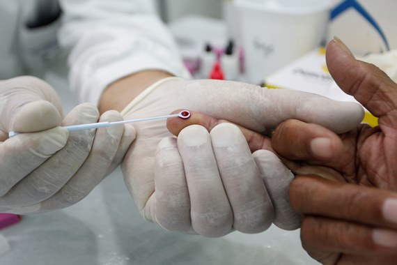 SES oferece testagem rápida de HIV pelo Dia Mundial de Combate à Aids