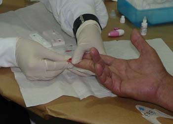 SES realiza testes rápidos em São Gonçalo para identificar casos de hepatites B e C