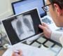 OMS recomenda novo diagnóstico e tratamento para a tuberculose multirresistente