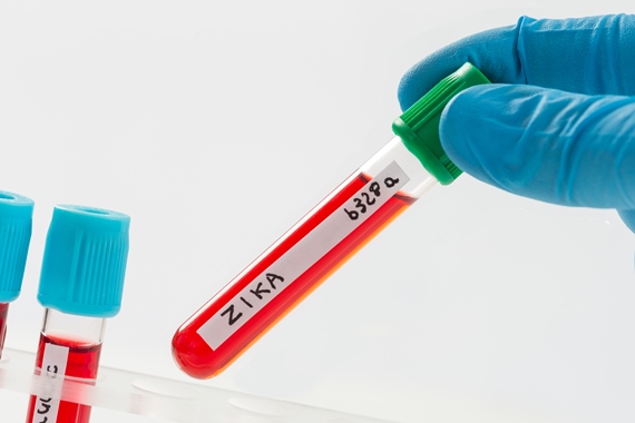 ONU cria fundo de resposta para financiar combate ao vírus Zika