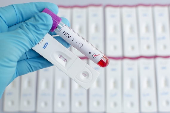 Para reduzir mortes por hepatite, OPAS defende investimento em prevenção e tratamento