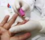 Rio de Janeiro ganha Unidade Móvel de Testagem rápida de Aids
