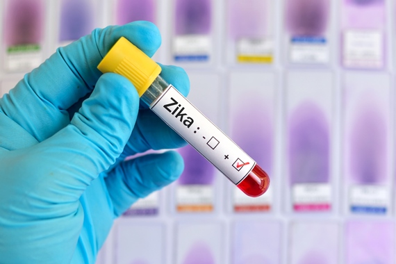 OMS afirma que Brasil tem agido rápido nas investigações do vírus Zika 