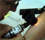 Gerência Estadual do Programa de Hanseníase promove teleconferência sobre a doença
