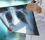 OMS publica novas recomendações para acelerar progressos contra a tuberculose