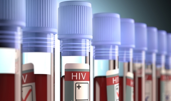 Zika: estudo avalia doença em pacientes com HIV controlado