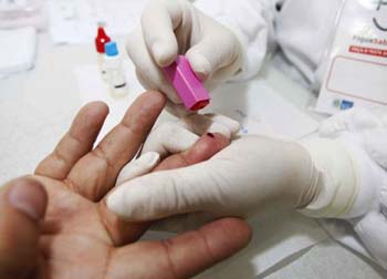 Rio de Janeiro ganha Unidade Móvel de Testagem rápida de Aids