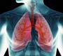 Dia Mundial de Luta contra a Tuberculose: atividades buscam conscientizar população sobre a doença