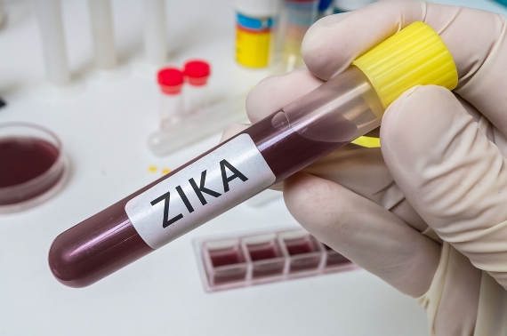 Anvisa concede registro a teste que detecta zika em até 20 minutos