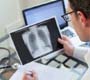 Tuberculose: estratégias para o controle das doenças transmissíveis em populações de maior vulnerabilidade