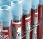 75% das pessoas com HIV no mundo conhecem seu estado sorológico