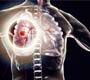 OMS pede ação urgente para acabar com a tuberculose