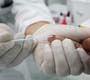 SES oferece testagem rápida de HIV pelo Dia Mundial de Combate à Aids