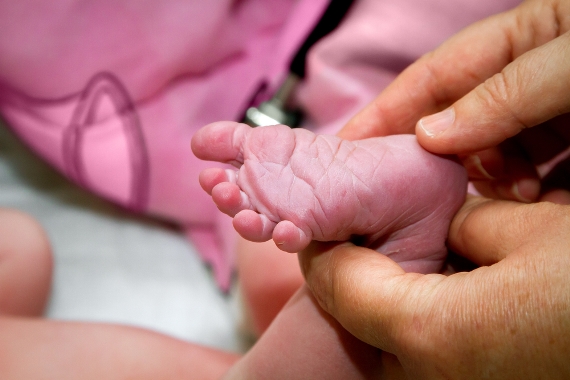 SES realiza 14 mil testes do pezinho por mês