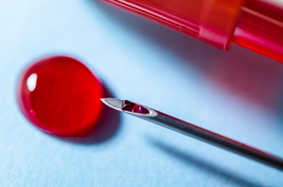 Hepatite C: a importância do diagnóstico precoce