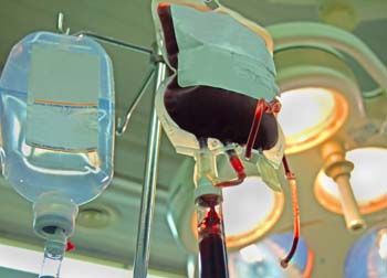 SUS fará transplante de medula óssea para tratar pessoas com doença falciforme