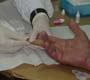 SES realiza testes rápidos em São Gonçalo para identificar casos de hepatites B e C