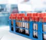 Fiocruz conduzirá estudo inédito sobre prevenção ao HIV