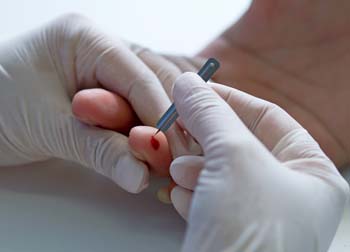 Dia Mundial da Luta Contra Hepatites Virais: Secretaria de Saúde realiza testagem rápida e vacinação em Nova Iguaçu