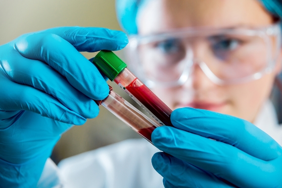 Pesquisa indica diagnóstico de tumores através de exame de sangue
