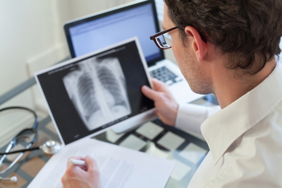OMS recomenda novo diagnóstico e tratamento para a tuberculose multirresistente