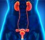 Doença renal crônica atinge 10% da população mundial